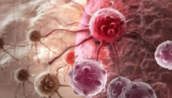 The most important reason for the rapid spread of cancer cases around the world has been discovered