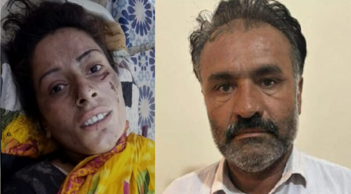 Accused Arrested in Torture Case: Woman's Leg Broken in Gill Town, Nowshero Feroze