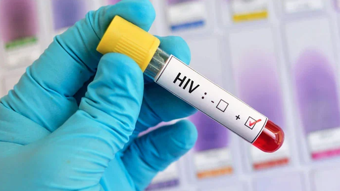 Pakistan Faces Surge in HIV Cases: 9,713 Infection